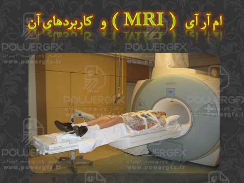 پاورپوینت ام آر آی(MRI)